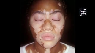 راز تکان دهنده درباره تغییر رنگ پوست مایکل جکسون