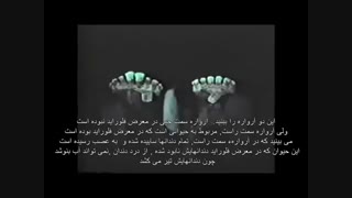 فلوراید سم است 2