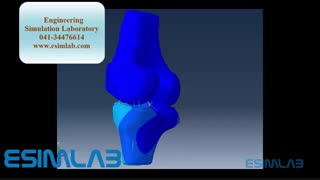 شبیه سازی مکانیزم و تنش در مفاصل بدن انسان -  اباکوس ،انسیس،بیو مکانیک- ABAQUS -ANSYS-BIOMECHANICS FINITE ELEMENT METHOD