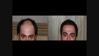 مرکز تخصصی موی رنسانس