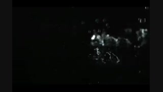 تو از تبار بارانی... جراحی لثه