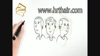 کاشت مو به روشSUT مرکز مو رنسانس