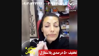 پلاسما ژل گونه در کلینیک آراد