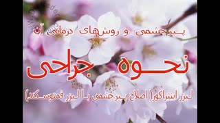 عمل جراحی پیرچشمی(اینتراکور)-مرکز چشم پزشکی دکتر علیرضا نادری