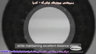 کارگذاری کمرا برای اصلاح پیرچشمی-مرکز چشم پزشکی دکتر  عیرضا نادری