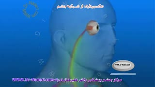 آنژیوگرافی شبکیه - مرکز چشم پزشکی دکتر علیرضا نادری