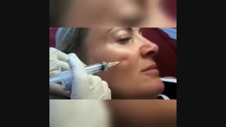 مزوتراپی و جوانسازی پوست رادیوگرافی دندان