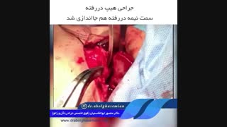 دختر دو ساله با دررفتگی مادرزادی نسبی در لگن