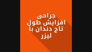 جراحی افزایش طول تاج دندان با لیزر