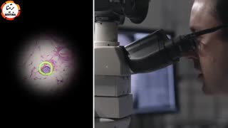 تشخیص سرطان با استفاده از هوش مصنوعی گوگل