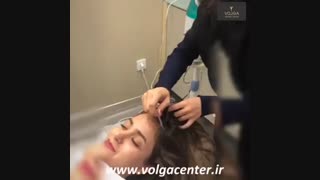 ترمودرمی و ماساژ موی سر