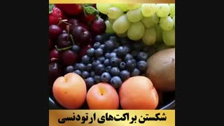 ارتودنسی تهران | دکتر داوودیان