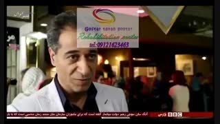 انواع سندروم داون، علت، علائم، تشخیص و درمان آن|گفتار توان گستر البرز09121623463