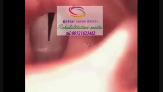 بهترین مراکز گفتاردرمانی در جنوب کرج|گفتار توان گستر البرز09121623463