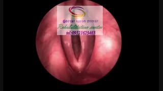 مجهزترین مراکز اختلالات بلع در کرج|گفتار توان گستر البرز09121623463