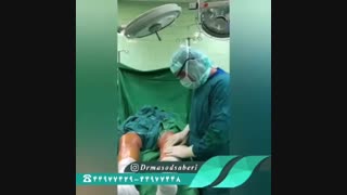 فیلم تعویض مفصل زانو دو طرفه همزمان