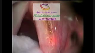کلینیک فوق تخصصی تصویربرداری حنجره در کرج|گفتار توان گستر البرز09121623463