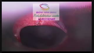 مجهزترین مراکز درمانی اختلالات بلع و گفتاردرمانی کرج|گفتار توان گستر البرز09121623463