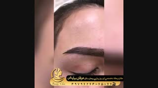 فیلم نمونه کاشت ابرو