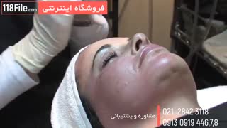 چگونه صورت خود را بدون لک کنیم لیپوست